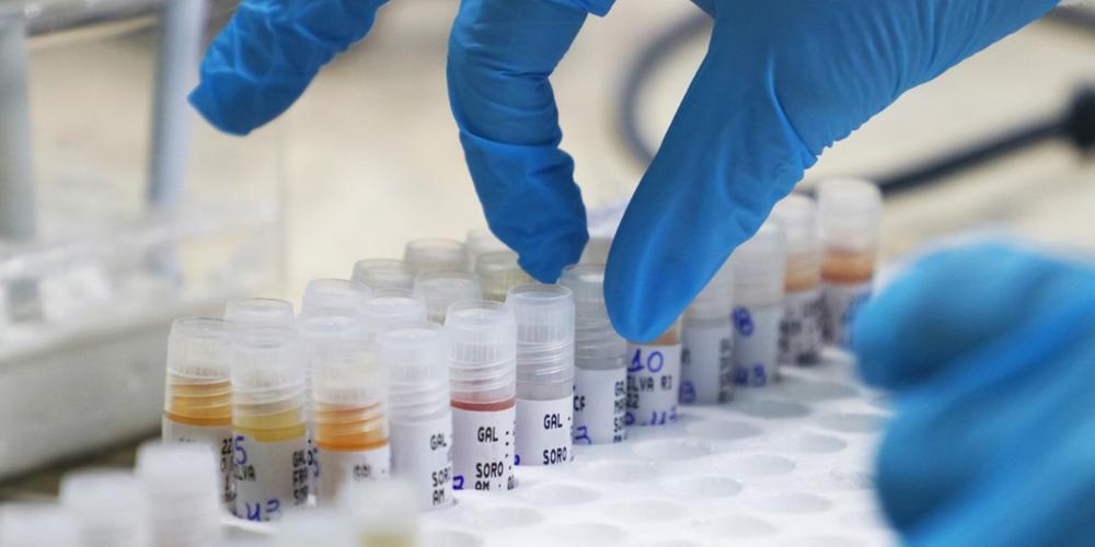 Veja atualiza&ccedil;&atilde;o mais recente dos boletins da Covid-19, Mpox e vacina&ccedil;&atilde;o no  Amazonas