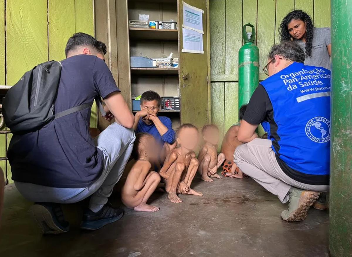 Crianças yanomami em atendimento médico, severamente desnutridas (Foto: Reprodução)
