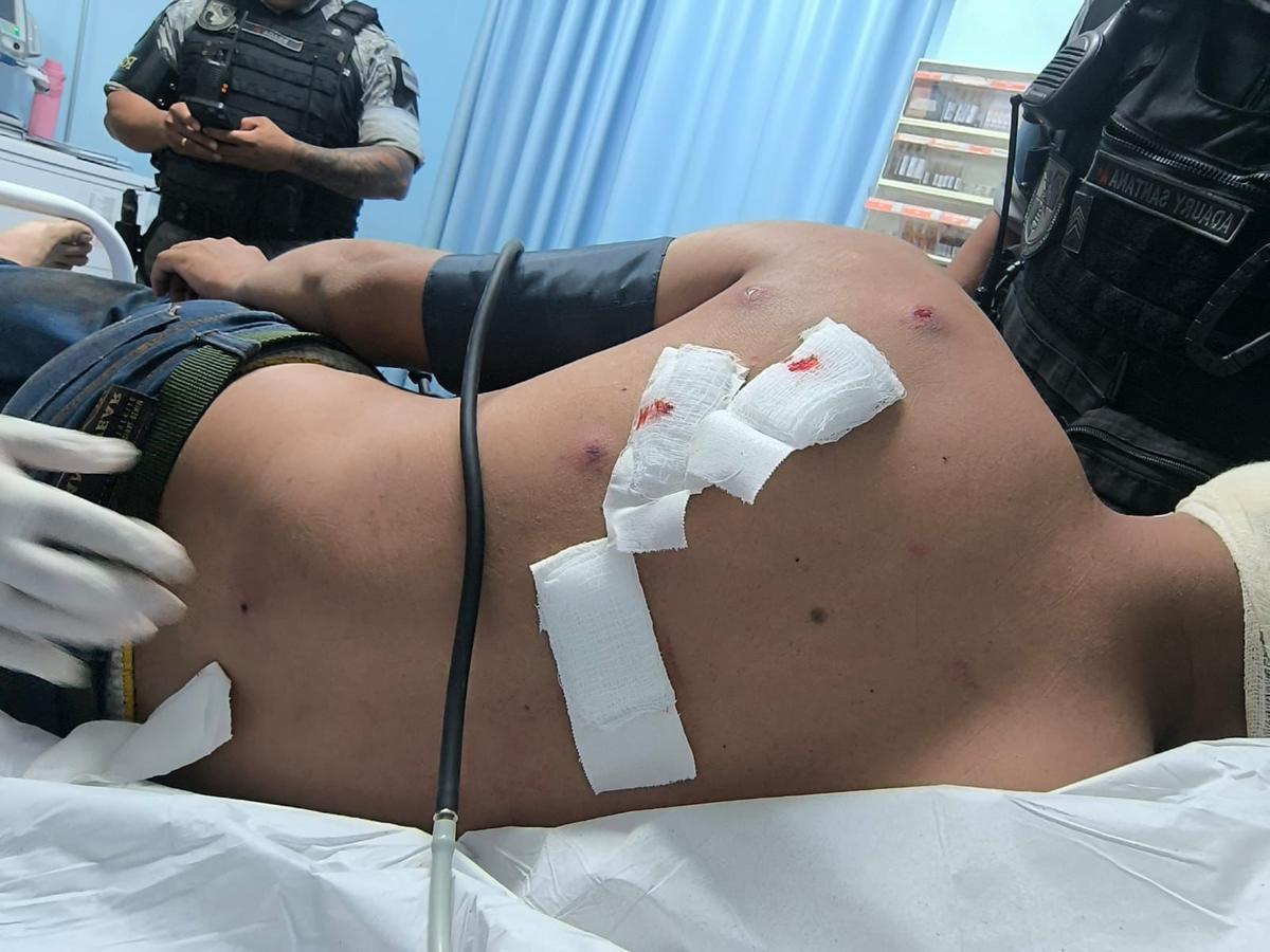 A vítima conseguiu escapar com vida após a tortura