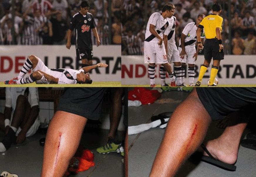 Violência do Libertad deixa marca na perna de Diego Souza