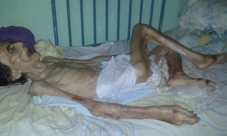 Idosa morre pesando apenas 25 quilos após sofrer maus tratos