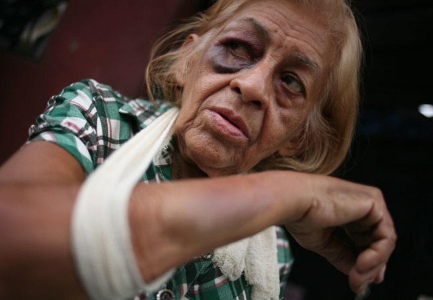 Idosa de 80 anos é espancada e acusa dono de churrascaria