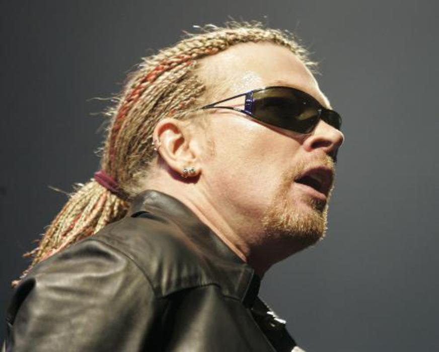 Axl Rose atira microfone em plateia e quebra dente de fã