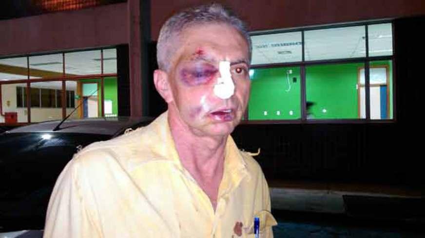 Funcionário é agredido com socos na Afeam
