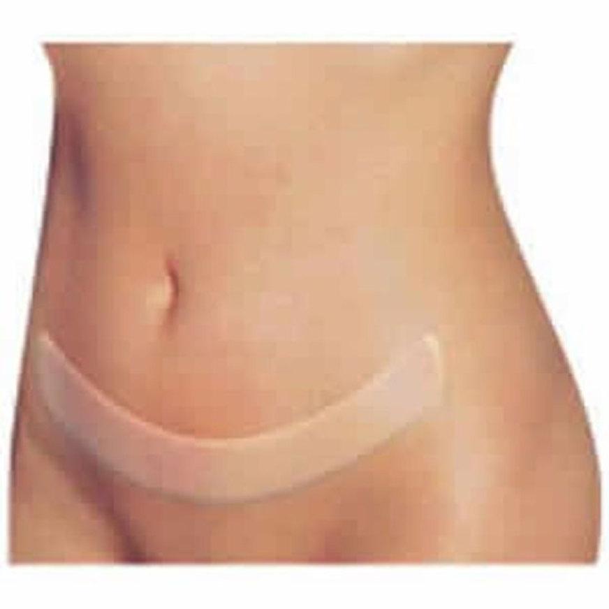 Abdominoplastia: o que é, como é feita, para quem é indicada e quais seus riscos