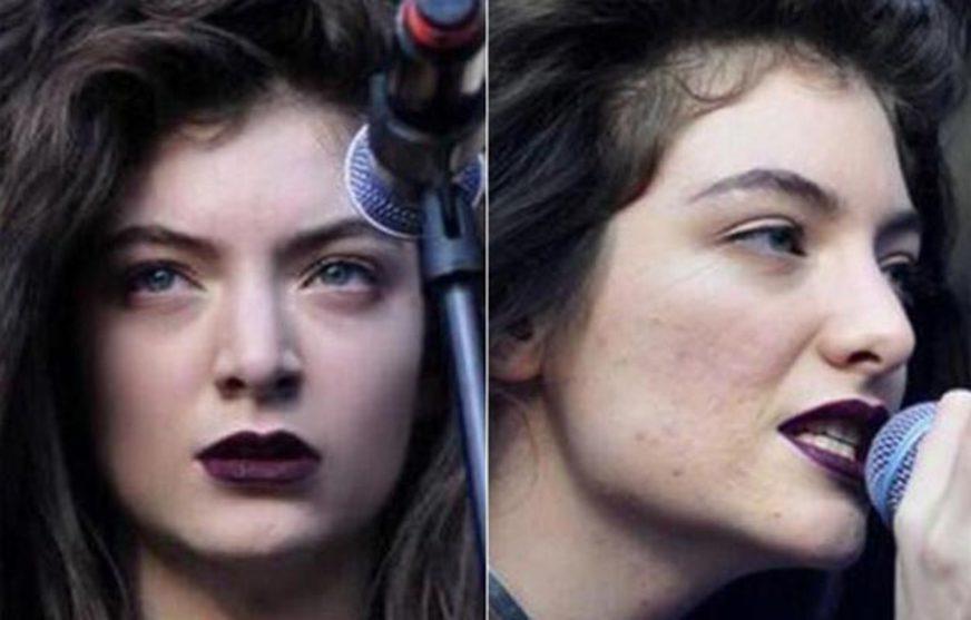 Lorde posta foto com retoques e diz ”falhas são ok’