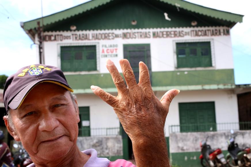 Desamparados e entregues à própria sorte, ex-operários formam ‘legião de mutilados’