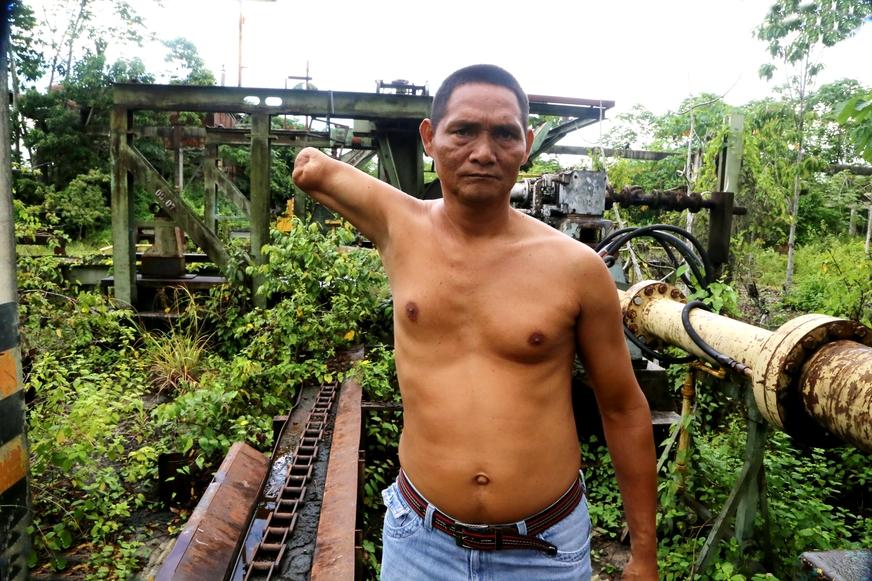 Trabalhadores mutilados são esquecidos em Itacoatiara