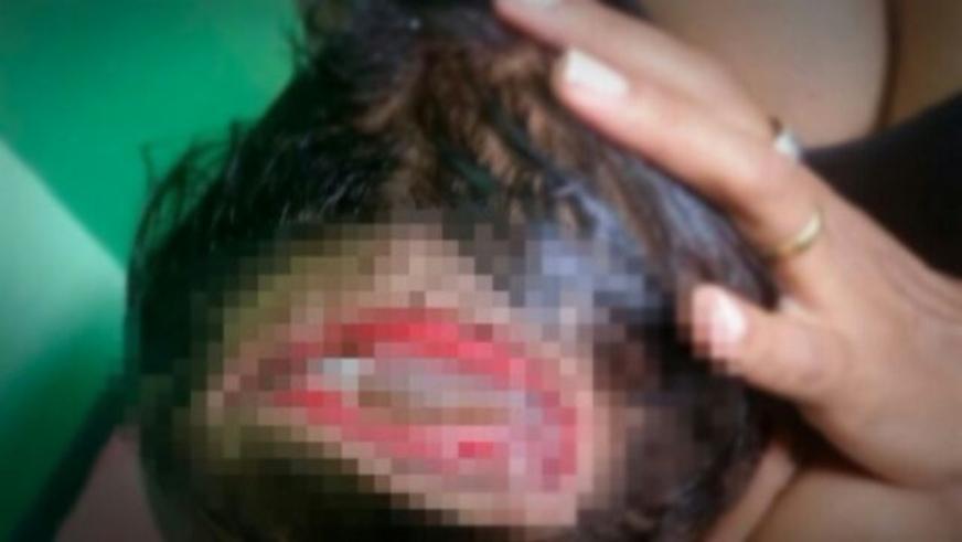 Acusado de ter atingido cabeça do sobrinho de 10 meses com terçado é capturado