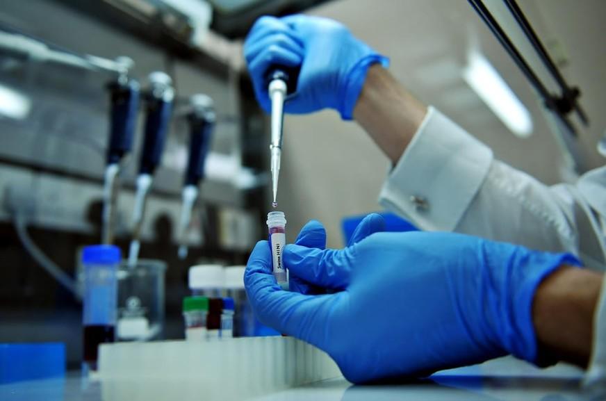 Experiência chinesa contra Aids é bem-sucedida, diz especialista