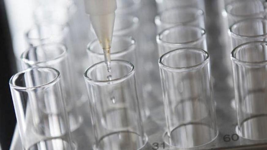 Anvisa suspende produtos de limpeza com fórmulas diferentes das registradas