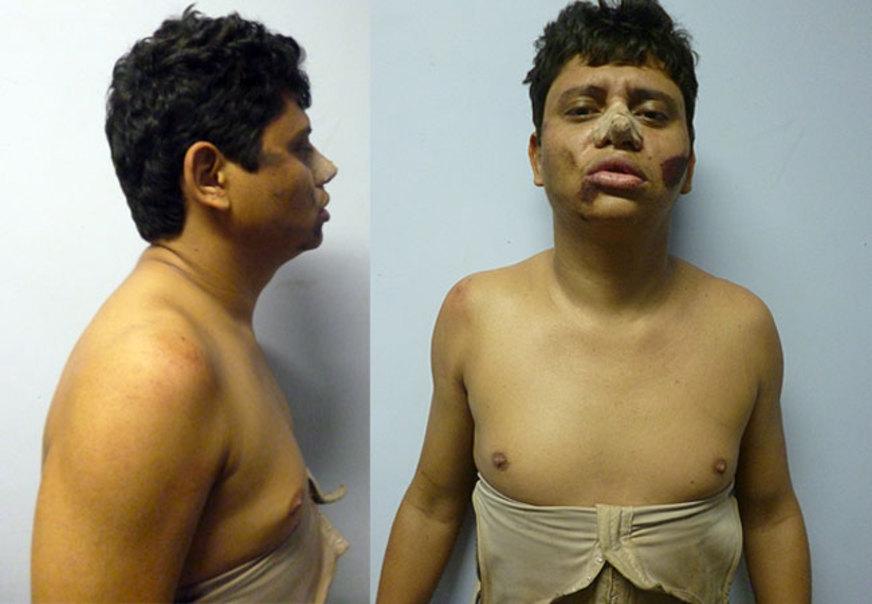 ‘Vainer Pepê’, gerente do tráfico da FDN, é executado em Fortaleza, diz delegado