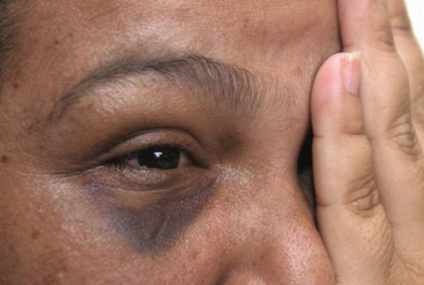 Violência contra as mulheres