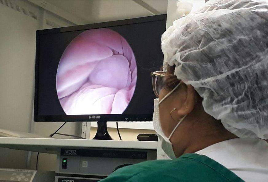 FCecon aumenta número de procedimentos de endoscopia no primeiro trimestre de 2018