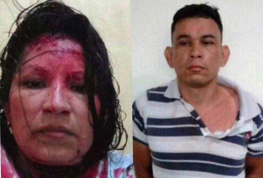 Professora é esfaqueada na cabeça e pescoço pelo marido no município de Humaitá