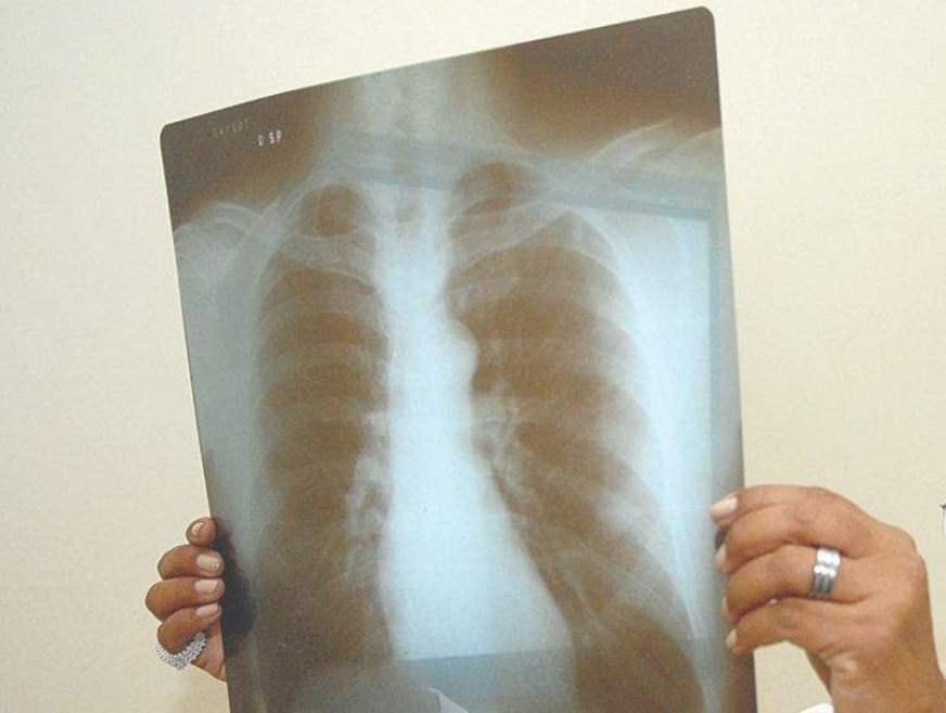 Conselho Regional de Medicina divulga ranking das doenças mais comuns no AM