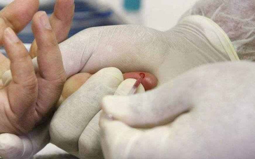 Centro de Testagem para HIV/Aids é inaugurado no Centro de Manaus