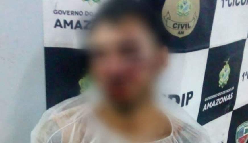 Homem suspeito de cometer assalto e estupro é espancado perto do T1