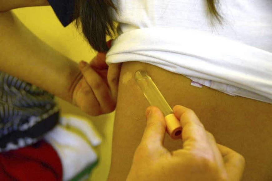 Projeto identifica 4 casos suspeitos de hanseníase em escolas de Manaus