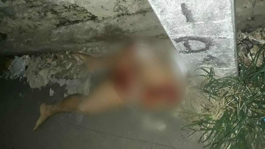 Par de pernas de mulher é abandonado em beco do bairro Compensa 2