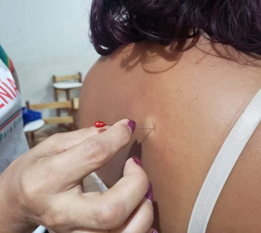 Campanha Janeiro Roxo estimula diagnóstico precoce da hanseníase