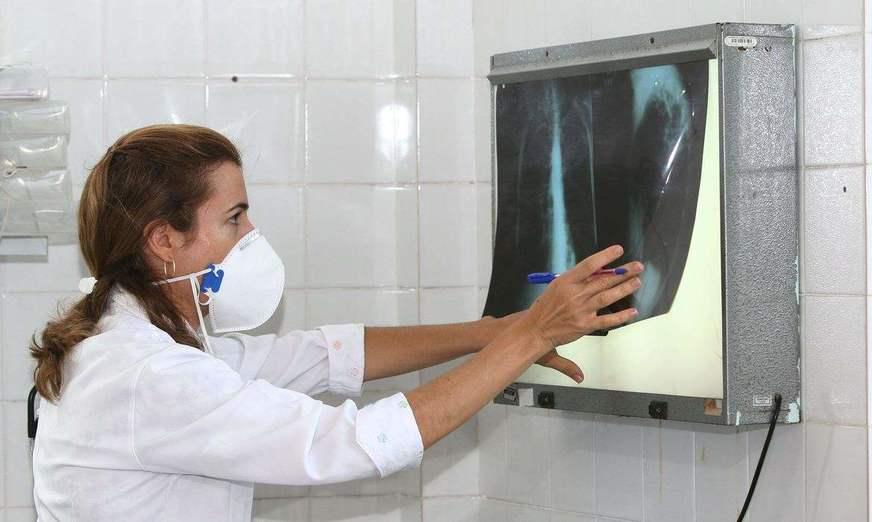Tratamento da tuberculose não deve ser descuidado, diz OMS