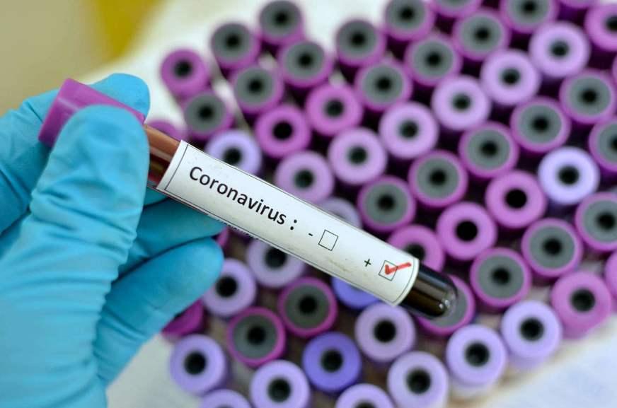 Anvisa aprova três novos testes de covid-19