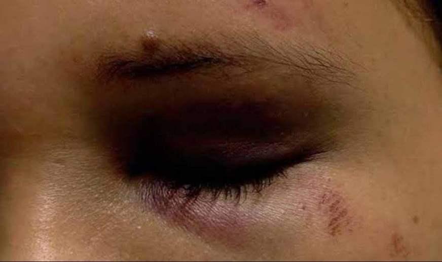 Homem é preso em flagrante suspeito de espancar irmã no São José