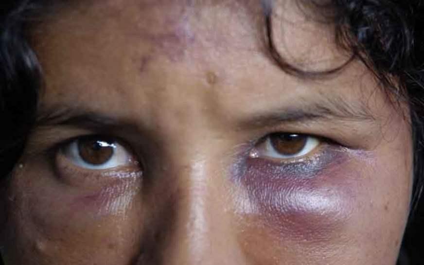 Mulheres, violência e tolerância