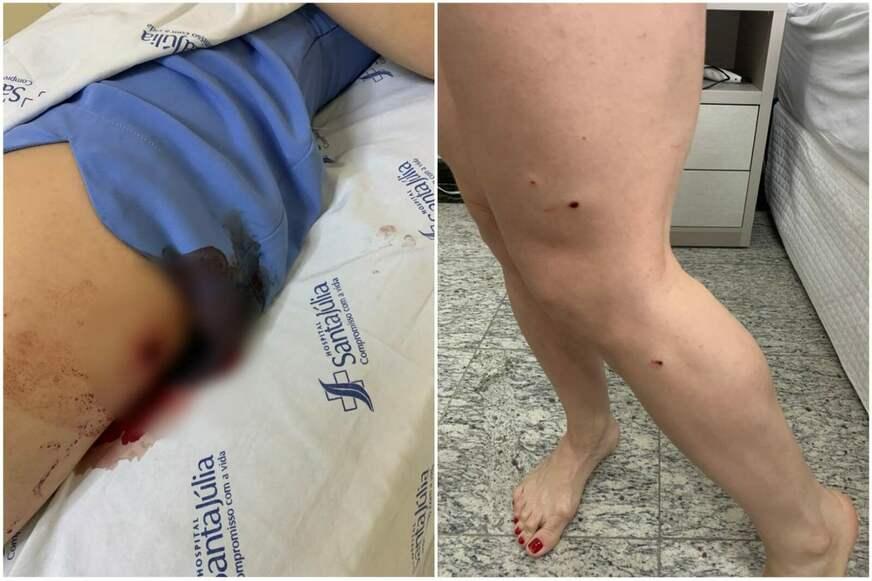 Dona de funerária e funcionário sofrem tentativa de homicídio em Manaus
