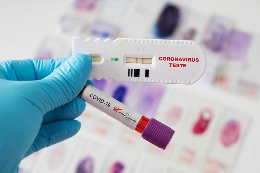 Covid-19: anticorpos podem durar até 12 meses após infecção