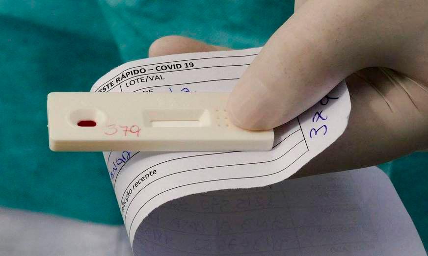 Cientistas desenvolvem teste de detecção de covid-19 pelo suor