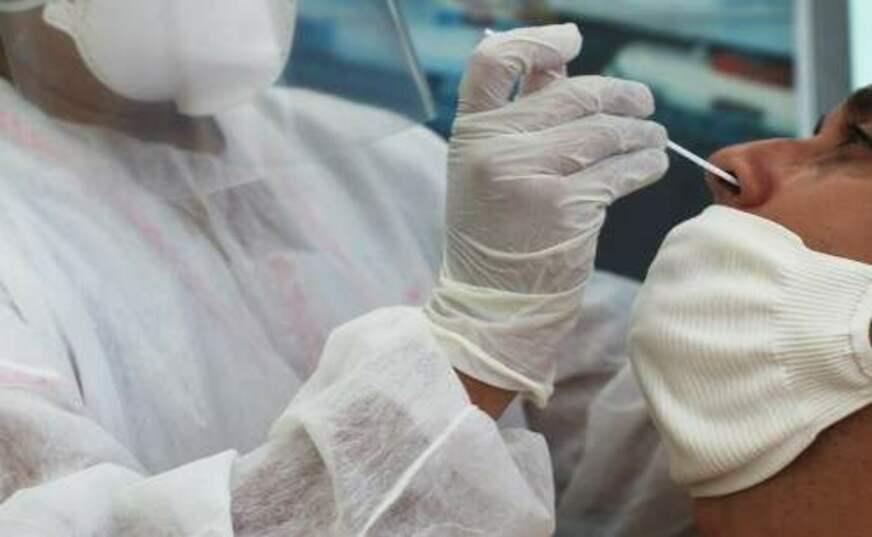 Boletim epidemiológico da Covid-19 no Amazonas é divulgado neste domingo (03)
