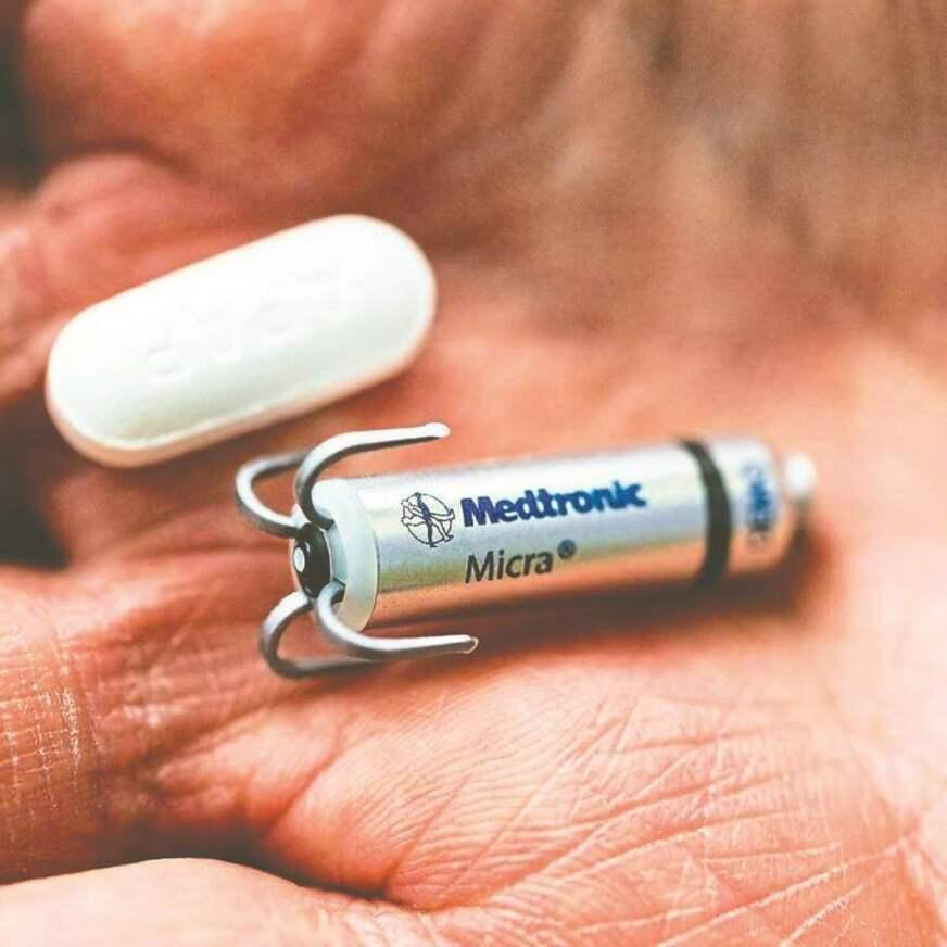 Menor marca-passo do mundo propõe reduzir o risco de infecções