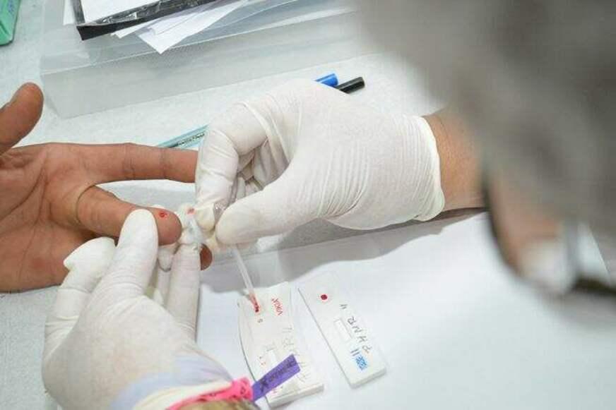 Concurso da PM Amazonas exige exame de HIV como critério de seleção