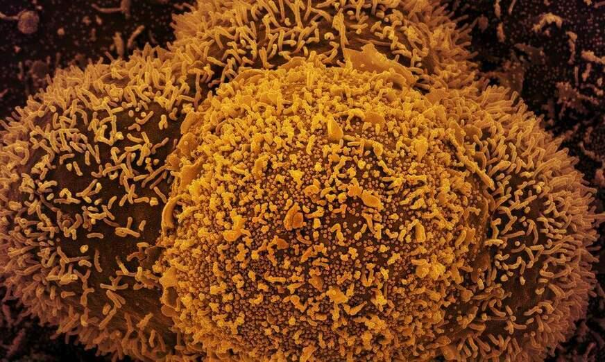 Ômicron é identificada em 93% de testes positivos de covid-19 no Amazonas