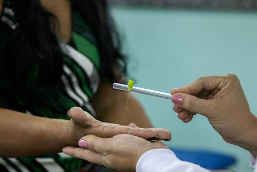 Projeto inédito busca estimar a magnitude da hanseníase no BR
