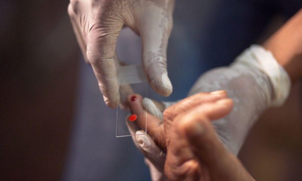 Amazonas é o estado com a maior incidência de malária em 2021