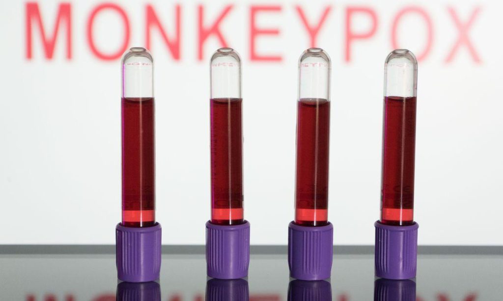 Primeiras vacinas contra Monkeypox devem chegar em setembro, diz Ministério