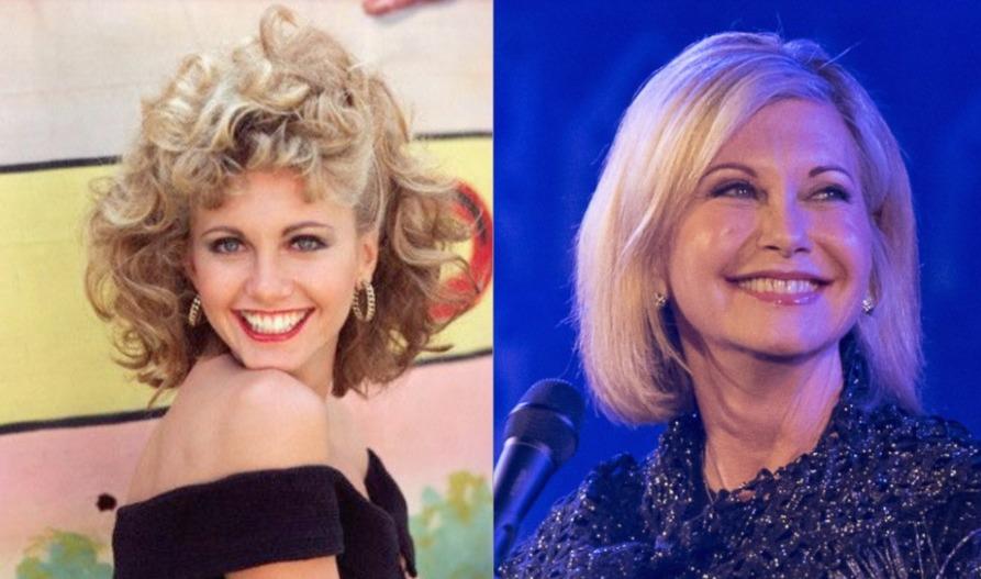 Olivia Newton-John, estrela de ‘Grease’, morre aos 73 anos