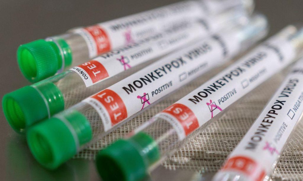 Monkeypox: transmissão local da doença no Amazonas está confirmada