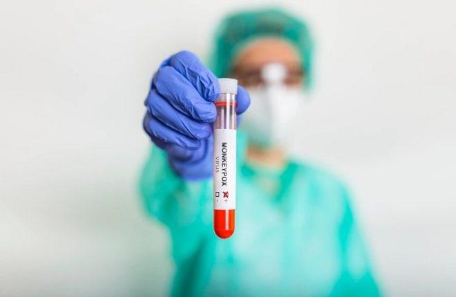 Sobe para 9 o número de casos confirmados de monkeypox no Amazonas