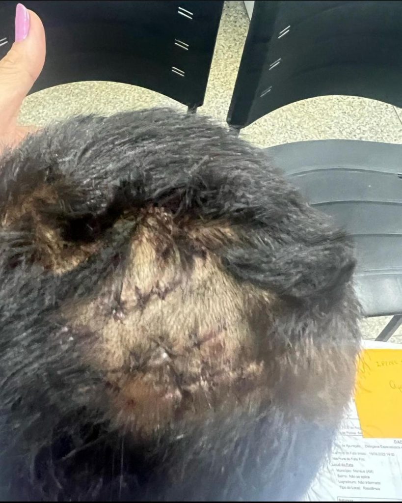 Criança de seis anos é agredida na cabeça e agressor escapa de flagrante