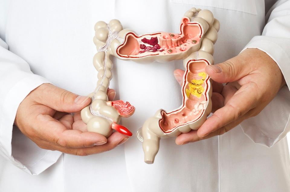 Médicos explicam causas e sintomas do câncer no intestino