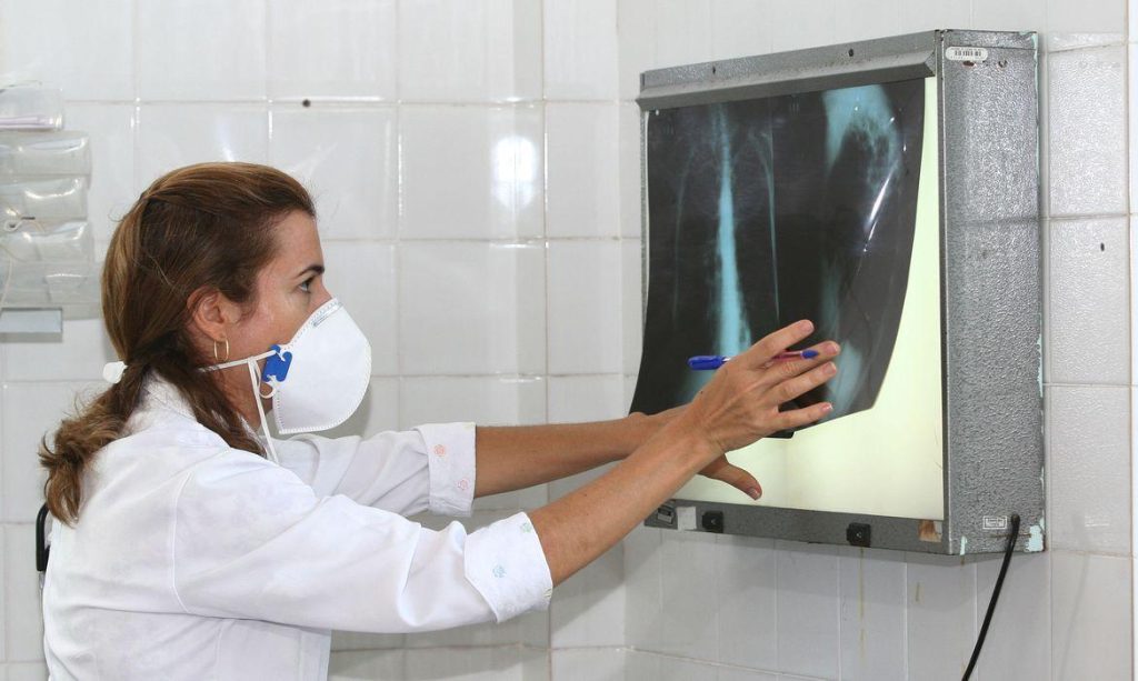O desafio de enfrentar o avanço da tuberculose