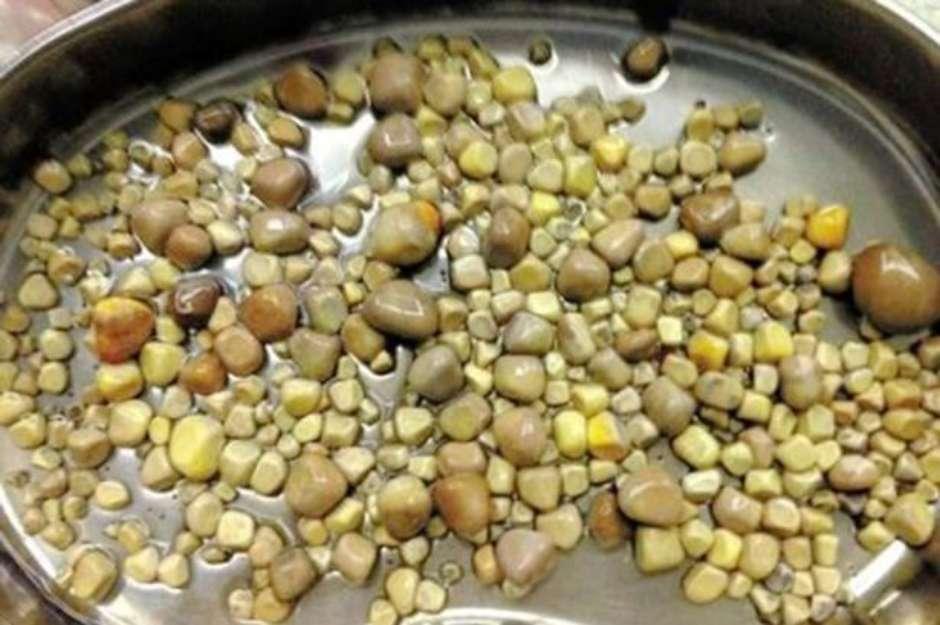 Pedra no rim: Saúde orienta como prevenir e tratar a doença