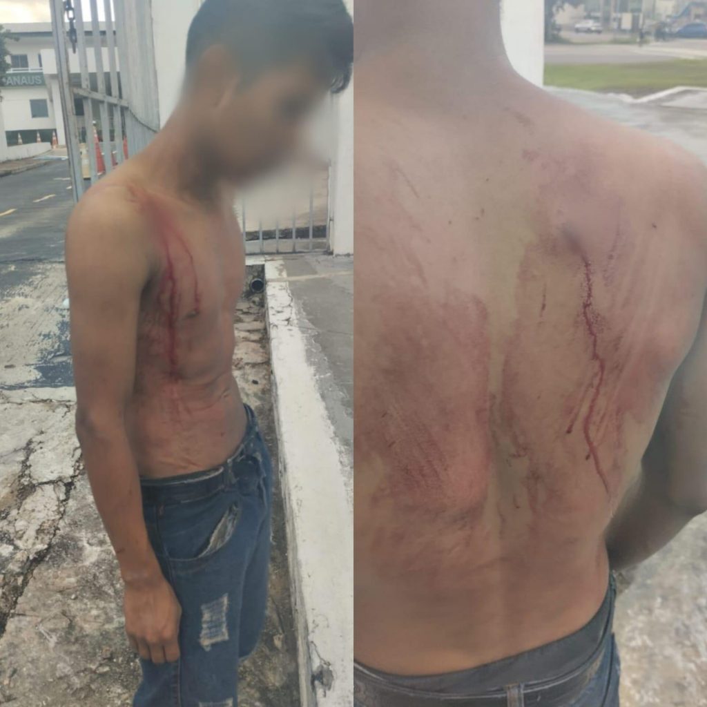 Irmãos são baleados na Praça 14