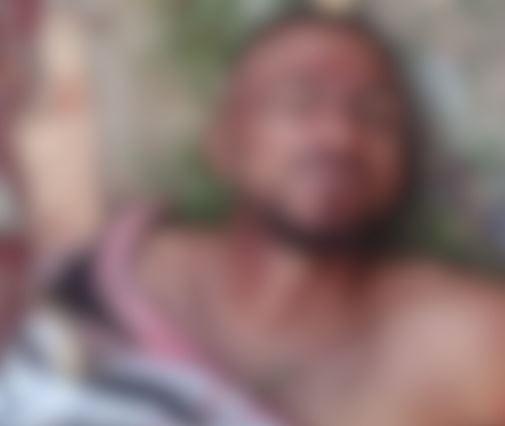 Assassinado com tiros na cabeça, nádegas e perna, no bairro Jorge Teixeira
