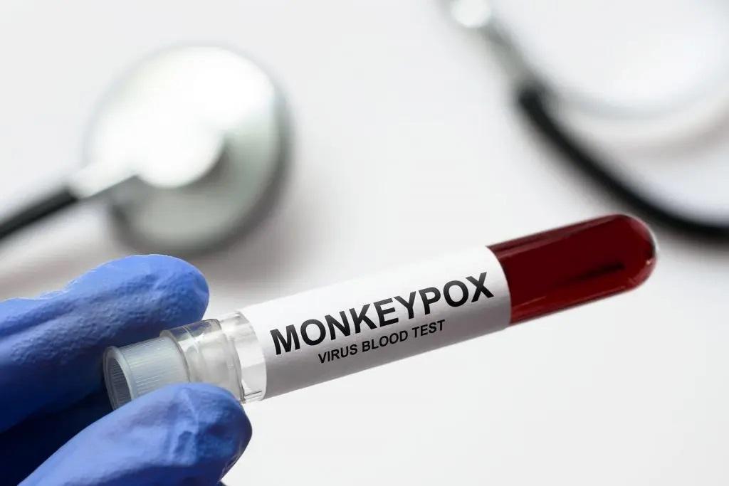 Mpox não é nova covid, diz diretor da OMS na Europa