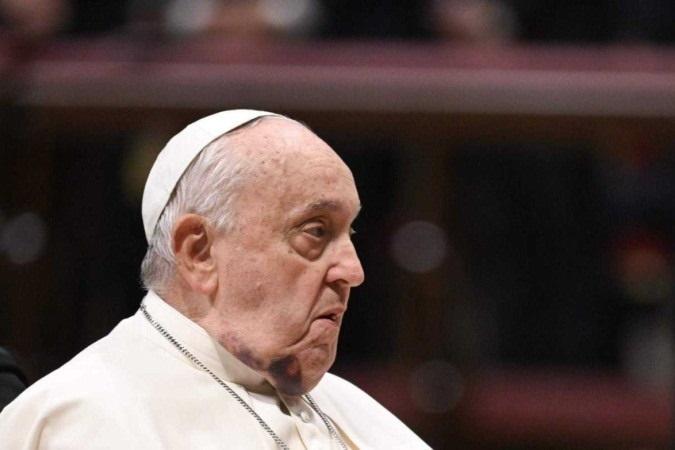 Papa Francisco é internado em Roma com bronquite